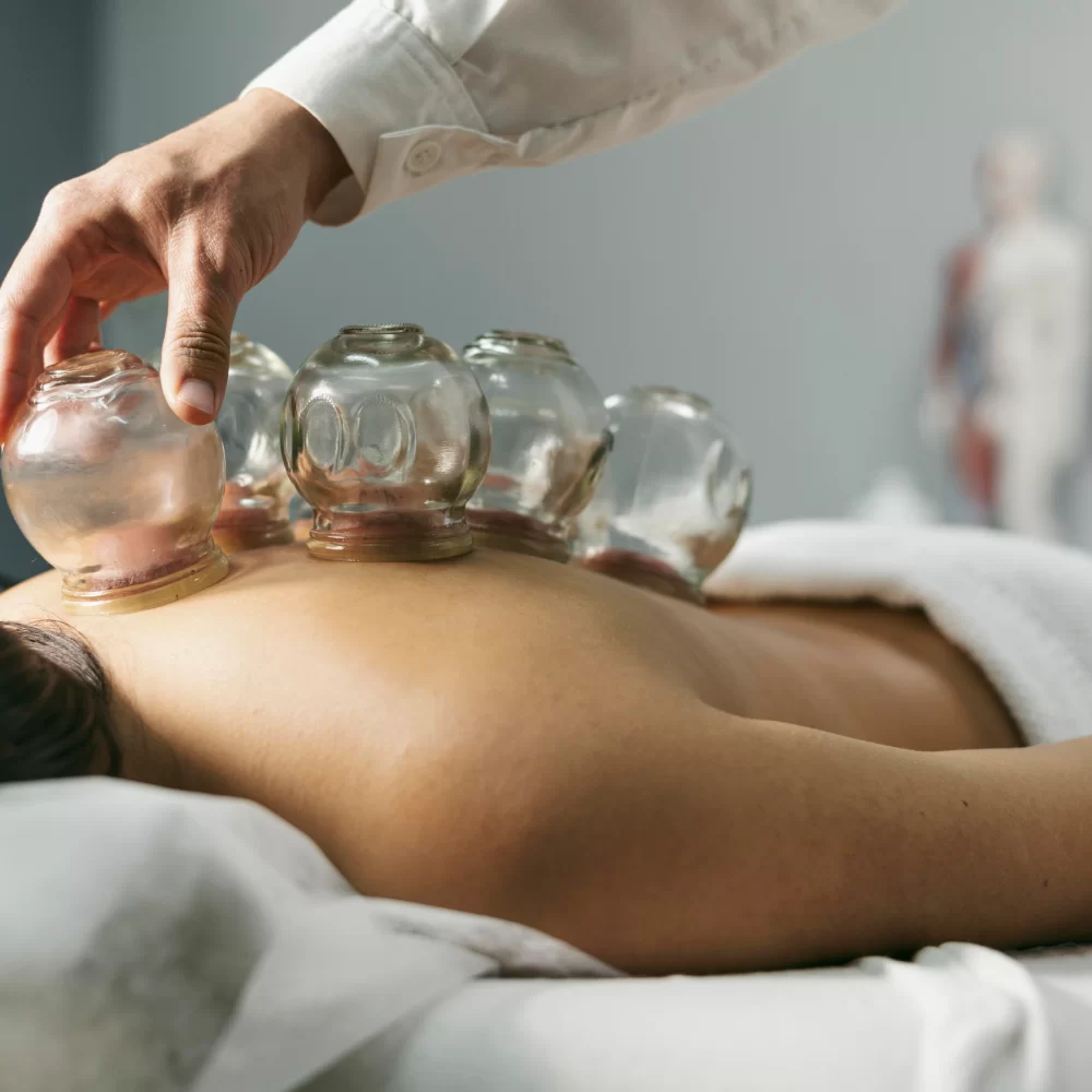 Cupping-Therapy